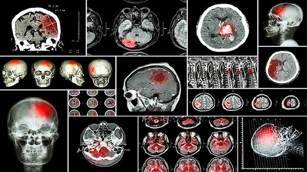 秋天雾霾严峻易患病？教你4招做到科学防护，少患病！